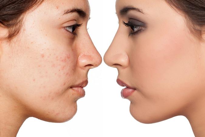 Dr Ronald B. Prussick, Washington Dermatology Center Providing Chemical Peels