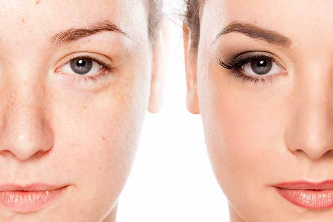 Kensington area ask, does acne treatment through a dermatologist work