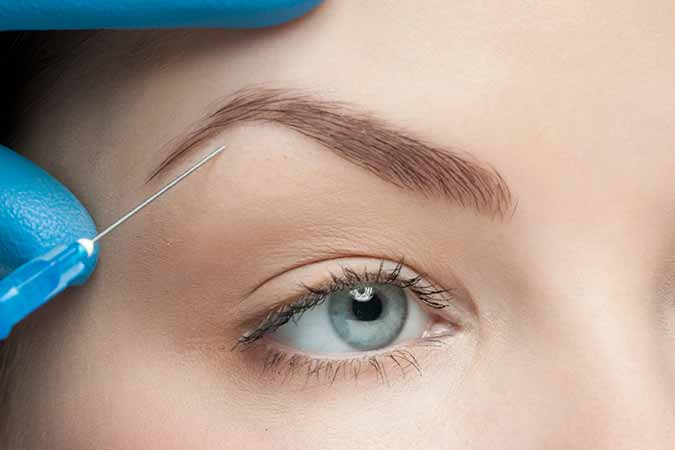 What you need to know about Botox Treatment