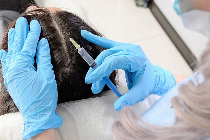 Scalp Psoriasis treatment from dermatologist in Ijamsville
