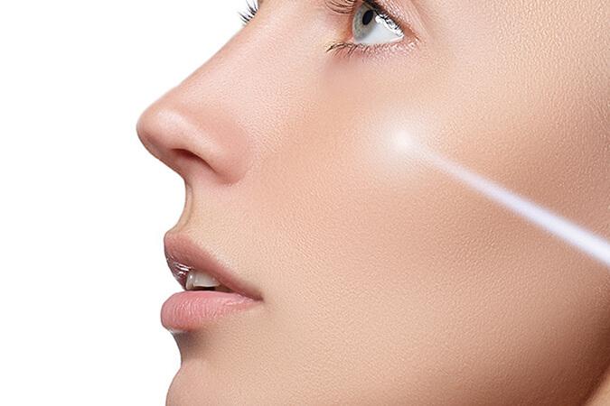 What is IPL Laser Therapy Frederick