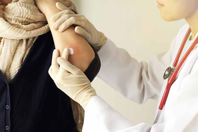 Dr. Ron Prussick and Washington Dermatology Center advanced treatment for psoriasis safely resolves symptoms in Rockville MD.